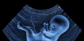 ویژگی های گردش خون در جنین انسان: آناتومی، نمودار و شرح همودینامیک