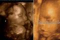 Augļa foto, vēdera foto, ultraskaņa un video par bērna attīstību 26. nedēļā.